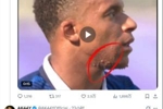 姆巴佩脸上长痘痘上热搜？赛后照和采访均显示他皮肤正常